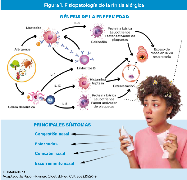 Figura 1 – Fisiopatología de la rinitis alérgica